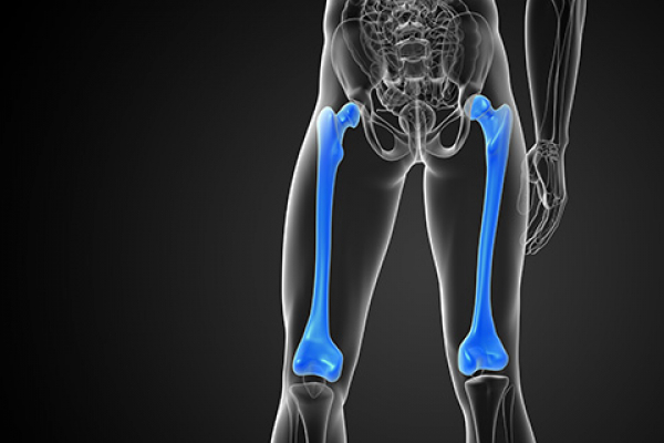 UNIB boosts identification of lower limb disorders